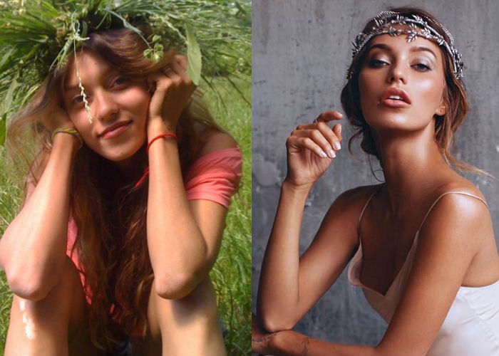 Известная русская телеведущая, певица и блогер Регина Тодоренко до и после пластики носа, губ фото