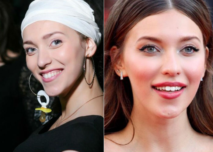 Известная русская телеведущая, певица и блогер Регина Тодоренко до и после пластики носа фото
