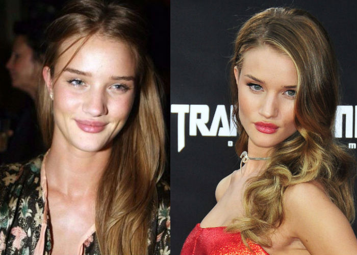 Известная красавица топ модель Рози Хантингтон Уайтли до и после ринопластики фото