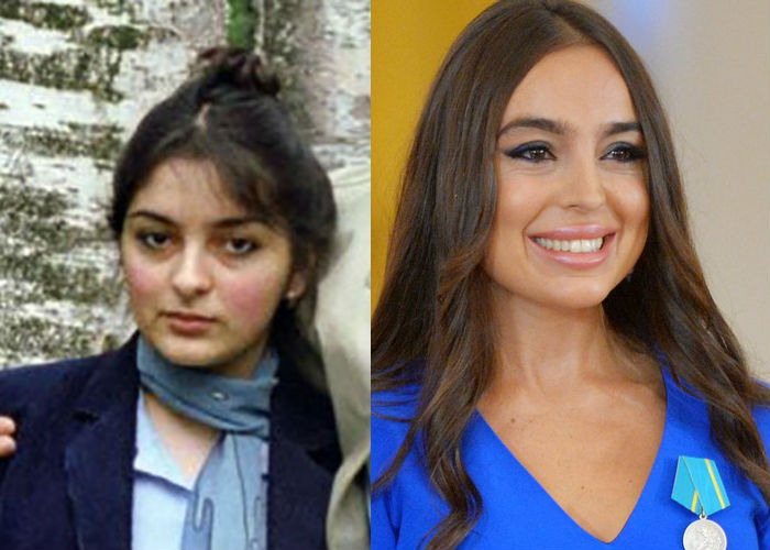 Красавица поэтесса Лейла Алиева до и после пластики фото