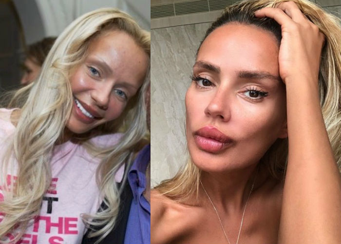 Известная светская львица Кристина Сысоева до и после пластики лица фото