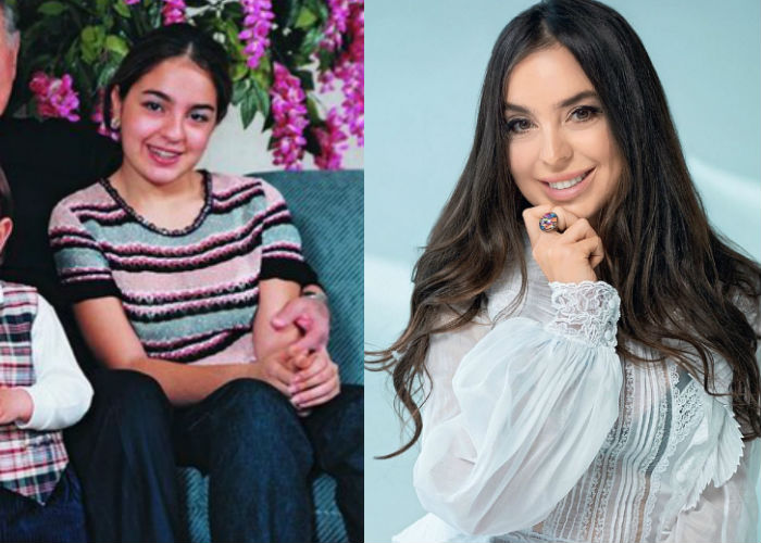Красавица поэтесса Лейла Алиева до и после пластики лица фото