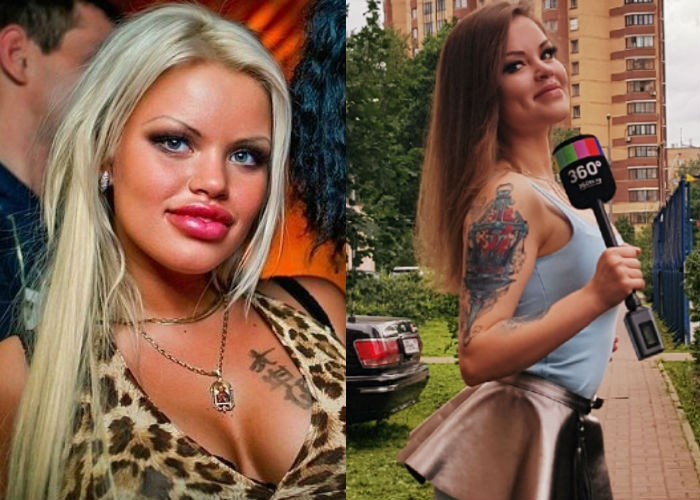 Модель Олеся Малибу до и после пластики лица, увеличения груди и губ фото