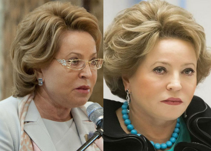 Русский дипломат и политик Матвиенко Валентина до и после омолаживающей пластики лица фото