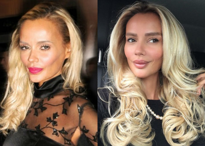 Кристина Сысоева до и после пластики лица фото