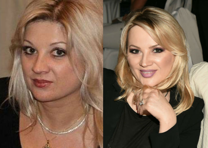 Инна Михайлова до и после пластики фото