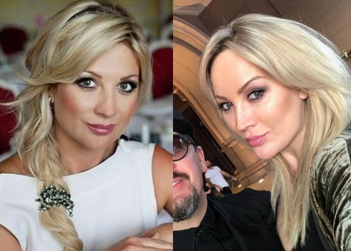 Жена известного певца Стаса Михайлова Инна Михайлова до и после пластики носа фото