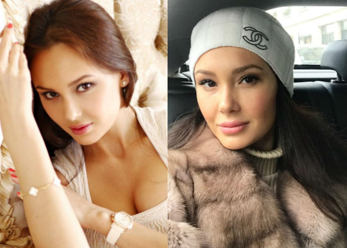 Оперная певица Аида Гарифуллина до и после пластики фото