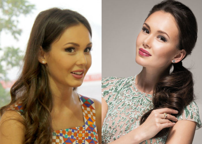 Известная оперная певица Аида Гарифуллина до и после пластики фото