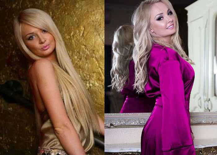 Участница телешоу Дом-2 Дарья Пынзарь до и после пластики груди, носа и уколов красоты фото