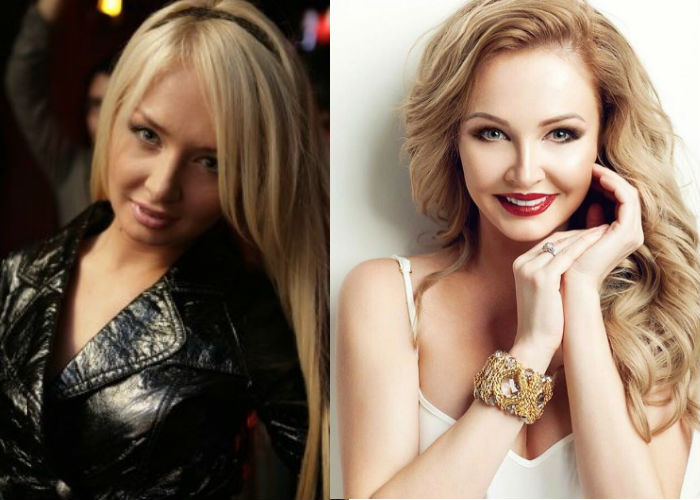 Участница телестройки Дом-2 Дарья Пынзарь до и после пластики груди, носа и уколов красоты фото