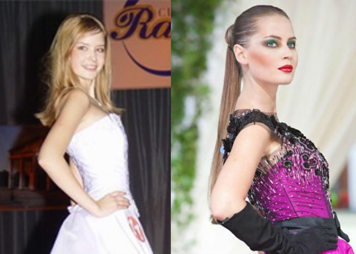 Жена певца Эмина Алена Гаврилова до и после пластики носа и губ фото