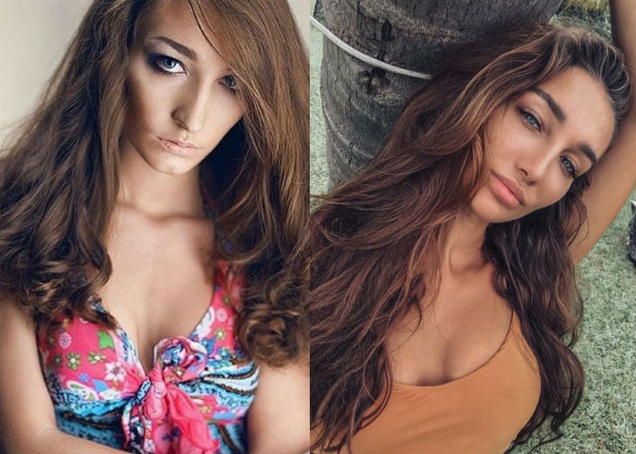 Интернет модель и блогер Анюта Рай после пластики лица и тела фото