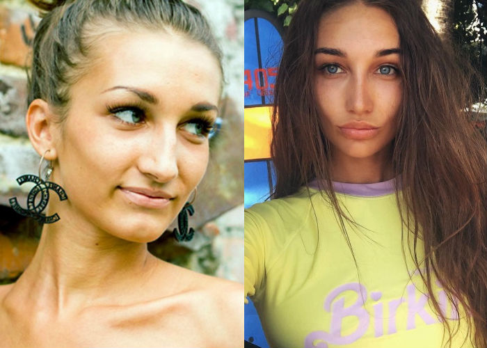 Модель и блогер Анюта Рай до и после пластики лица и тела фото