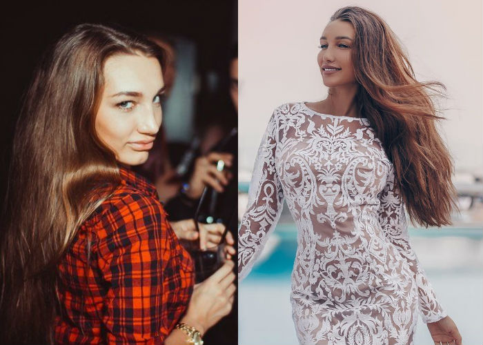 Блогер Анюта Рай до и после пластики лица и груди фото