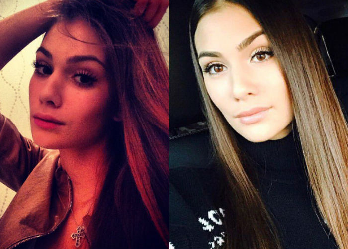 Актриса и модель, жена хоккеиста Александра Овечкина Анастасия Шубская до и после удачной пластики лица фото