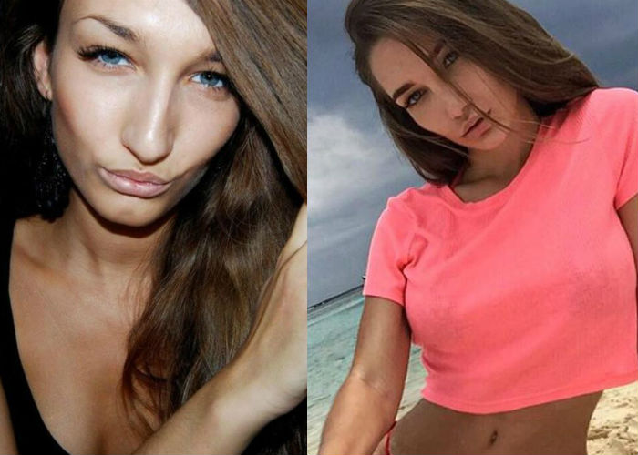 Анюта Рай до и после пластики лица фото