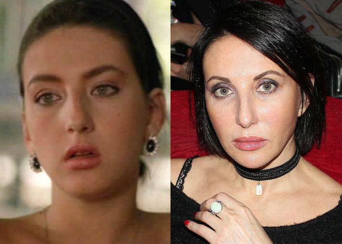 Известная актриса Алика Смехова до и после пластики носа и скул фото