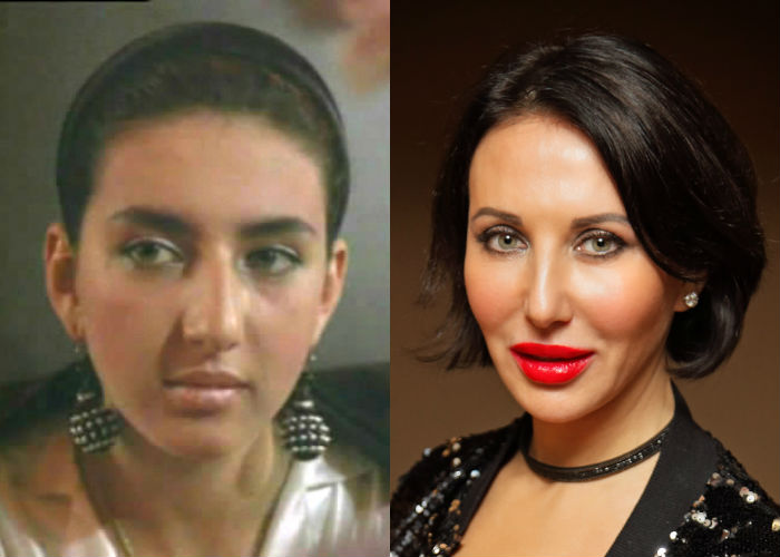 Алика Смехова до и после пластики лица фото