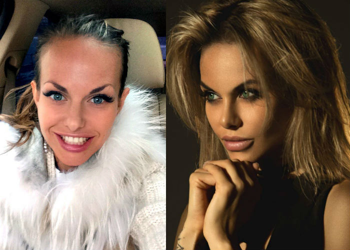 Фотомодель и бизнесвумен Аурика Алехина до и после пластики носа и губ фото