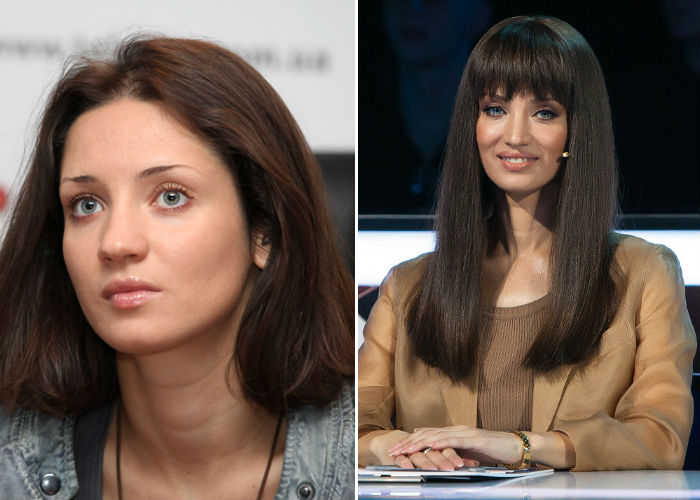 Татьяна Денисова до и после пластики фото