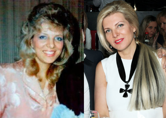 Жена русского певца Александра Малинина Эмма Малинина до и после пластики лица фото